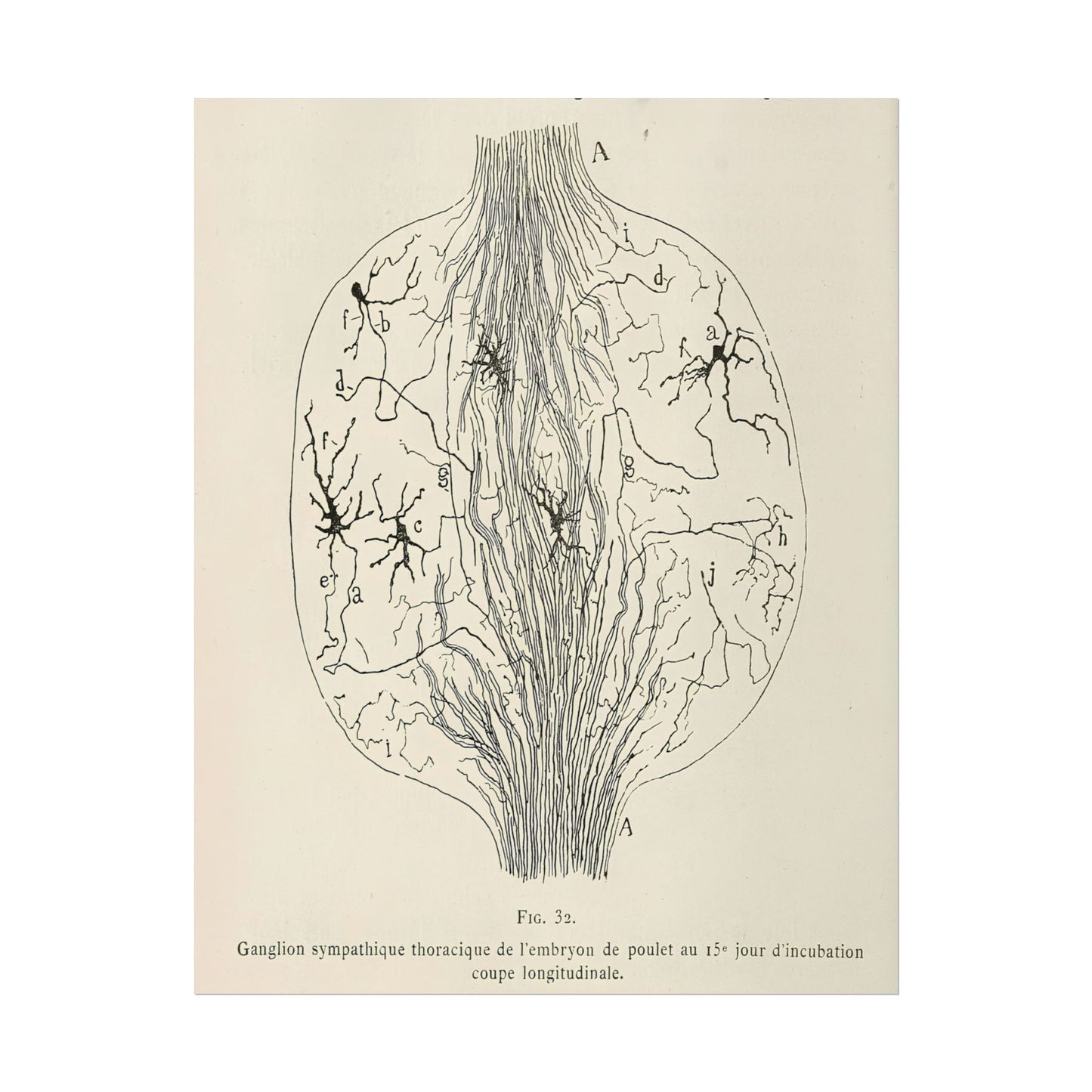Neuron Drawing poster by Franz Von Stuck - 11x14 inch print